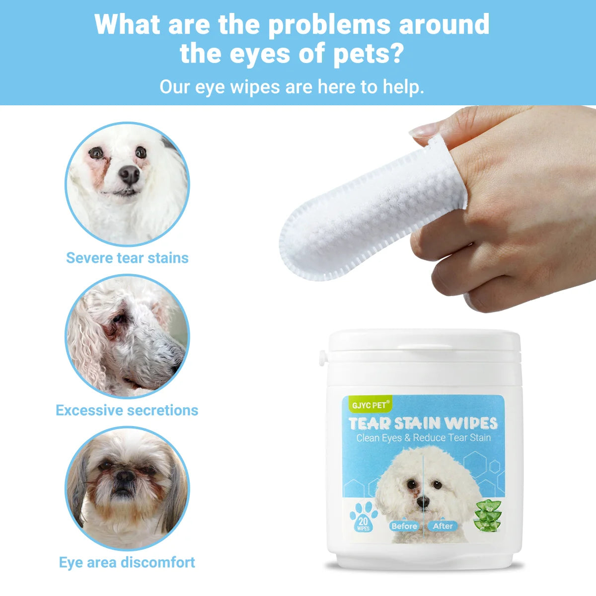 Pet Eye Finger Wipes Gentle Hypoallergenic Tear Stain Remover For All Breeds Dogs Cats Daily Eye Cleaning Grooming